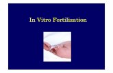 In Vitro Fertilizationstaff.unila.ac.id/gnugroho/files/2020/04/In-Vitro-Fertilization-1.pdf · 5. Fertilization of the eggs to form embryos may fail even when the egg(s) and sperm