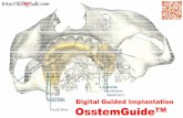 Digital Guided Implantation OsstemGuideTM · (Microsoft PowerPoint - osstemguide_En_ [ б ]) Author: ryan.jin Subject: osstem guide Keywords: osstem guide-کیت جراحی آستم