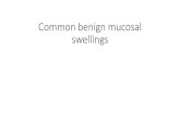 Common benign mucosal swellings - upjs.sk€¦ · Common benign mucosal swellings . FIBROUS POLYPS, EPULIDES AND DENTURE-INDUCED GRANULOMAS •Fibrous nodules are the most common