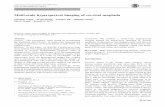 Multi-scale hyperspectral imaging of cervical neoplasiastaff.ustc.edu.cn/~swzhang/paper/JP22.pdf · Multi-scale hyperspectral imaging of cervical neoplasia ... second derivative Cervical