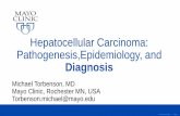 Hepatocellular Carcinoma: Pathogenesis,Epidemiology, and ...cpo-media.net/ECP/2019/Congress-Presentations/1155... · ©2015 MFMER | slide-1 Hepatocellular Carcinoma: Pathogenesis,Epidemiology,