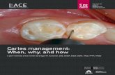 Caries management: When, why, and how · Caries management: When, why, and how ABSTRACT Restorative dentistry has become increasingly conservative in its treatment of incipient lesions
