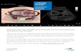CAEVimedix Ultrasound Simulator - CAE Healthcare · Accelerate learning in Ob/Gyn ultrasound with the most comprehensive and easy-to-use simulator CAE Vimedix Ob/Gyn is an effective