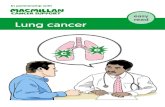 easy read Lung cancer - Macmillan Cancer Support · There are other treatments for lung cancer but the treatments that most people have are surgery, chemotherapy and radiotherapy.