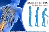 Osteoporosis -A Silent Disease