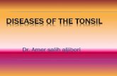 Diseases of the Tonsil…حاضرات_الفروع_/د-_عامر... · Chronic Tonsillitis: It is the chronic inflammation of the palatine tonsil which occurs as a result of repeated