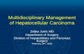 Multidisciplinary Management of Hepatocellular Carcinoma · Multidisciplinary Management of Hepatocellular Carcinoma . Zeljka Jutric MD . Department of Surgery. Division of Hepatobiliary