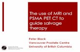 The use of MRI and PSMA PET CT to guide salvage therapy · PSMA PET CT to guide salvage therapy Peter Black Vancouver Prostate Centre University of British Columbia . ... distant