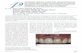 Immediate implant placement, reconstruction of compromised ... · of implant placement in healed sites.1 However, immediate implant placement in the esthetic zone is a challenging