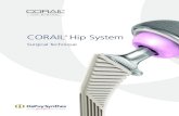 CORAIL Hip System - synthes.vo.llnwd.netsynthes.vo.llnwd.net/o16/LLNWMB8/US Mobile/Synthes... · Preoperative Planning Goals 1. Determine preoperative leg length discrepancy 2. Assess
