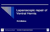 Laparoscopic repair of Ventral Hernia · Laparoscopic repair of Ventral Hernia R.K.Mishra . World Laparoscopy Hospital Essentials of Laparoscopic Surgery Access through palmers point