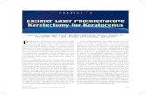 Excimer Laser Photorefractive Keratectomy for Ker Patientâ€™s understanding: (1) using an excimer laser