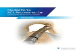 Medial Portal ACL Reconstruction - Zimmer Biomet...11 | Medial Portal ACL Reconstruction with Precision Flexible Reaming Instrumentation Surgical Technique Tibial Fixation Reference
