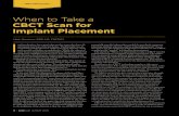 When to Take a CBCT Scan for Implant Placement · that CBCT is the imaging method of choice” (author’s emphasis). This created some concern. Theoretically, any dentist who read