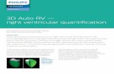3D Auto RV — right ventricular quantification...6 Medvedofsky D, et al. Novel Approach to Three-Dimensional Echocardiographic Quantification of Right Ventricular Volumes and Function