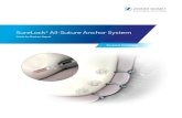 SureLock All-Suture Anchor System - Zimmer Biomet · 2020-01-13 · 2 | SureLock ® All-Suture System – Bankart Repair Surgical Technique Figure 1. Figure 2 *Curved and straight