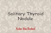 Solitary Thyroid Nodule - medicinebau.com€¦ · Solitary Thyroid Nodule Aisha Abu Rashed . Differential Diagnosis . Risk Factor For Malignancy:**** • • • • • • • •