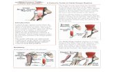 A Patient's Guide to Distal Biceps Rupture€¦ · about your pain, how your pain affects you, elbo Symptoms What does a ruptured distal biceps feel like? When the distal biceps tendon