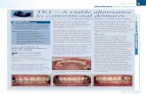 april 2014 9 denturealternatives TK1 – A viable ... TT... · TK1 – A viable alternative to conventional dentures Educational aims, ... less than implants, involve less invasive