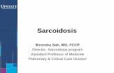 Sarcoidosis - SUNY Upstate Medical UniversityDiagnosis •Sarcoidosis is a diagnosis of exclusion •There is no objective test which can easily diagnose sarcoidosis. •Numerous exams