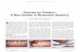Triceram on Titanium: A New Frontier in Restorative Dentistry · healthy 44-year-old female with 30-year-old PBM crowns teeth 11 and 21. These crowns are definitely long overdue for