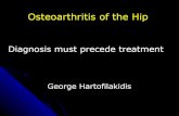 Osteoarthritis of the Hip - orthosurgery.gr · Idiopathic Osteoarthritis of the Hip: Incidence, Classification and Natural History of 272 cases. G. Hartofilakidis, Th.Karachalios