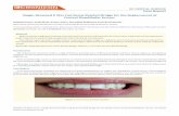 Cronicon OPEN ACCESS EC DENTAL SCIENCE Case Report … · 2018-12-21 · 73 Single-Retained E Max Cad Resin-Bonded Bridge for the Replacement of Central Mandibular Incisor Citation: