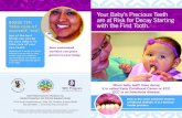 Your Baby’s Precious Teeth Bonus Tip: are at Risk for Decay …itcaonline.com/wp...Your-Babys-precious-teeth-are-at-risk-for-decay.pdf · will check his teeth and tell you how to