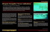 Herpes Simplex Virus Infection - Your Oral Health.ca · Herpes Simplex Virus Infection continued Is there a cure for herpes simplex? Not yet. The virus remains in nerve cells in the