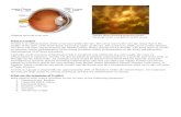 diseases/Uveitis/Uveitis tآ  Web view The main types of uveitis are anterior uveitis (inflammation of