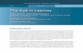 The Eye in Leprosy... · The Eye in Leprosy Mary Esther John Bairappagari ... Iridocyclitis / Uveitis 6. Scleritis 7. Glaucoma 8. Other related ocular complications FIG 1 Ocular manifestations