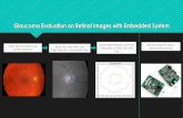 Glaucoma Evaluation on Retinal Images with Embedded System › courses › bme484 › All_demos_2016.pdfGlaucoma Evaluation on Retinal Images with Embedded System Optic Disc and Optic