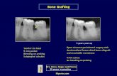 Bone Grafting - MartyNager.comCrown Lengthening Procedure ... Flapless Extraction, Immediate Implant, Non-loaded Provisional ... Palatal view of upper first molar with 7mm pocket.