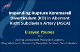 Impending Rupture Kommerell Diverticulum (KD) in Aberrant ... · Impending Rupture Kommerell Diverticulum (KD) in Aberrant Right Subclavian Artery (ASCA) Elsayed Younes MD Acting