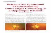 CHALLENGING CASES Plateau Iris Syndrome …bmctoday.net/glaucomatoday/pdfs/1109_08.pdfThe lens was clear and not intumescent in the patient’s right eye. Corneal pachymetry measured
