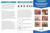 PATIENT ESSENTIALS The Basics Spot Melanoma Early Skin ... › wp-content › uploads › BakoDx... · A skin biopsy is a simple procedure in which a small sample of the skin lesion