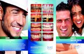 LOVE SIMPLY YOUR SMILE WHITER TEETH t t€¦ · No. If you have any of these on your front teeth, you may need to replace some of them after whitening. f. How will coffee, tea, smoking