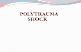 POLYTRAUMA SHOCK - Semmelweis Egyetem · 2015-03-12 · polytrauma iss > 20 and chest trauma ais > 2 ! polytrauma with abdominal thoracic inj. and shock (rr < 90 hgmm) !