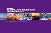 hip Replacement SuRgeRy - Dr. Tim O'Carrigan · 2017-11-29 · Hip anatomy and function The hip joint The hip joint is one of the largest weight bearing joints in the body. The hip