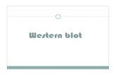 Western blot · 3. Place one sheet of blotting paper on top of sponge. Make sure it wet evenly and completely 4. Place the SDS gel onto the surface of the blotting paper 5. Place