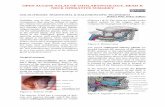 OPEN ACCESS ATLAS OF OTOLARYNGOLOGY, …vula.uct.ac.za/access/content/group/ba5fb1bd-be95-48e5...sialolithiasis Salivary gland endoscopy has been a major advance, not only in terms