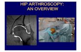 Review causes of hip and groin pain in athlete Discuss ... › parousiasis › hip › 72.pdf · Review causes of hip and groin pain in athlete Discuss indications for hip arthroscopy