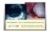 TRATAMIENTO DE LA ENDOMETRIOSISPÉLVICA › ... › cursosOrganizados › 2004_3_endometri… · Con endometriosis experimental se corrigió satisfactoriamente su fertilidad. Szamatowicz