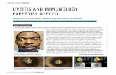 s CATARACT SURGERY CASE FILES UVEITIS AND IMMUNOLOGY ...€¦ · of profound vision loss in both eyes dating back to June 2016. The ocular history in both eyes is significant for