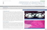 Case Report Metastases of Squamous Cell …...Carcinoma of Uterine Cervix to Duodenum: A Case Report Pathology Section Sanjay M. Chawhan1, aarti a. Dani2, Saroj a. MeShraM3, arChana