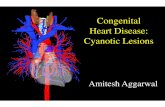 cyanotic congenital heart diseases - Yoladramiteshaggarwal.yolasite.com/resources/cyanotic... · 6 % of all congenital heart disease 1:3600 live births Most common cause of cyanosis
