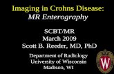 Imaging in Crohns Disease: MR Enterography...– MR enterography New opportunities: distinguish active from chronic disease. 952,420 non-elderly adults followed for three years 655,613
