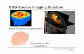 EEG Source Imaging Solution · 2010-08-17 · Fetal Brain Volumetry • Fetal brain volumetry is crucial for the quantitative evaluation of fetal development. • But it is limited
