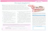 Scanned Image - Yellowpages.com · 2019-07-17 · Dental implant techniques can replace one or several missing teeth. In some patients, an entire set of artificial teeth can be carried