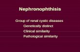 Group of renal cystic diseases Genetically distinct ... · renal ultrasound presumed diagnosis molecular genetic Renal biopsy. PCR for homozygous NPHP1 mutation.DNA from Diagnosis